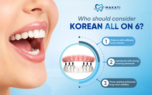 Key benefits of choosing Korean All-on-6 for stable full arch restoration